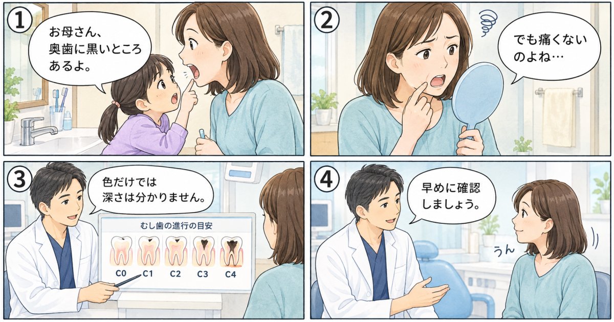 痛みなしの変色は要注意?むし歯進行度C0〜C4セルフチェック