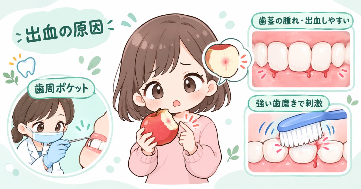 歯磨きや食事で歯茎から血が出る…歯周病？傷や磨き方も原因？