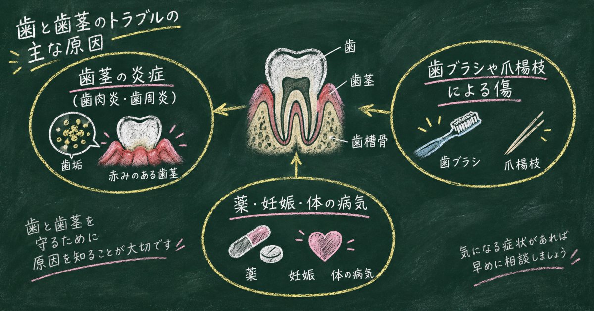 歯茎から血が出る原因は歯周病だけではない