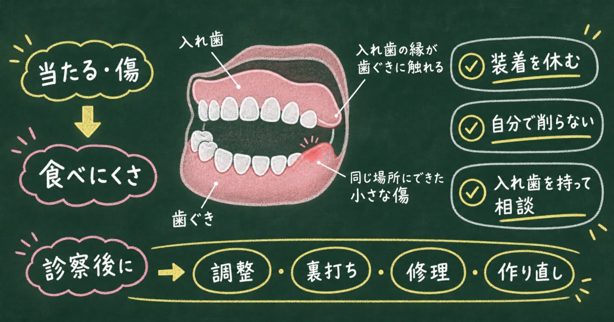 入れ歯が合わず歯ぐきに傷ができたら？使い続ける影響と受診の目安