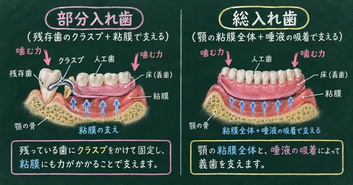 総入れ歯と部分入れ歯の違いは「残存歯の有無」と「支える場所・とどめる仕組み」